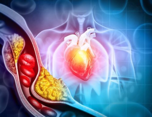 Birthe sitt høye kolesterolnivå og motstridende råd fra legene