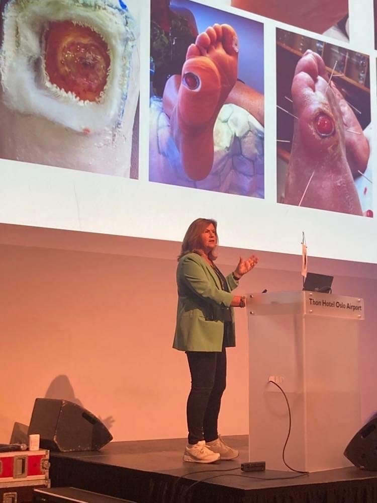 Vigdis har opplevd mange alvorlige komplikasjoner av diabetes type 1, som fotsår som ikke ville gro med fare for amputasjon, hjerteinfarkt, nedsatt syn med fare for blindhet, overvekt, revmatiske smerter, hodepine og humørsvingninger.