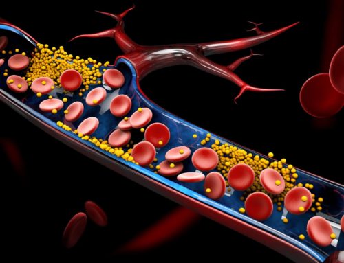 Hvor farlig er det å ha høyt LDL kolesterol? Bør man bruke statiner?