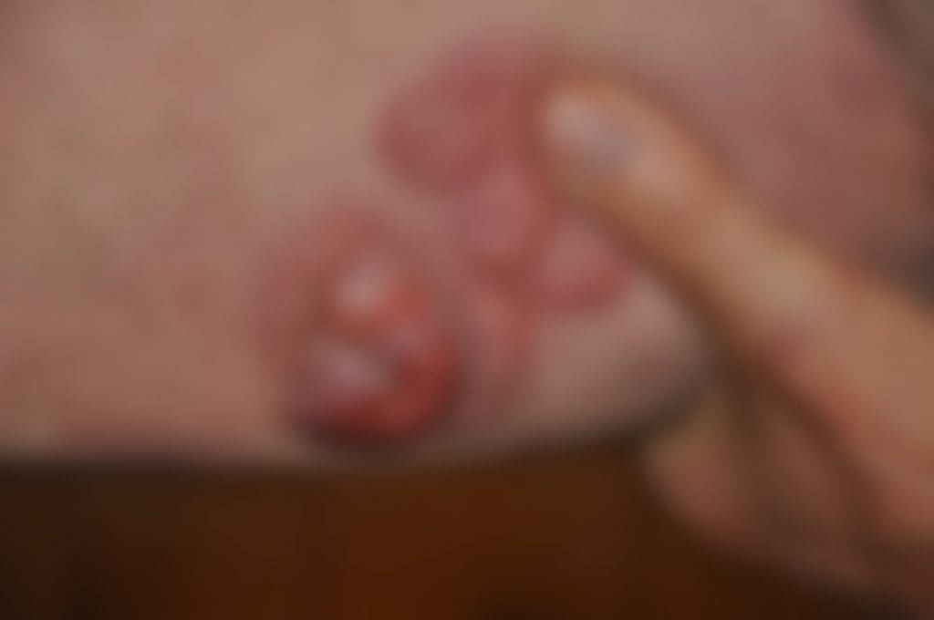 Terje fikk kreftdiagnosen i 2016 og hadde store svulster over hele kroppen.